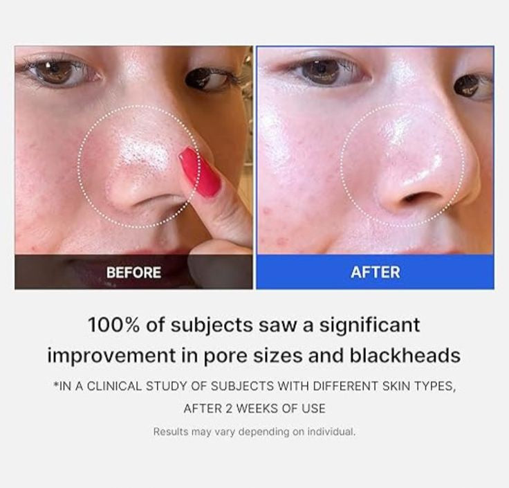 Zero Pore Pads 2.0